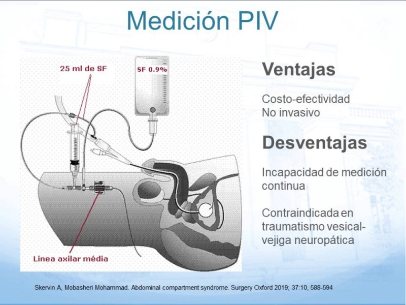 Diapositiva 9 de Síndrome Compartimental Abdominal