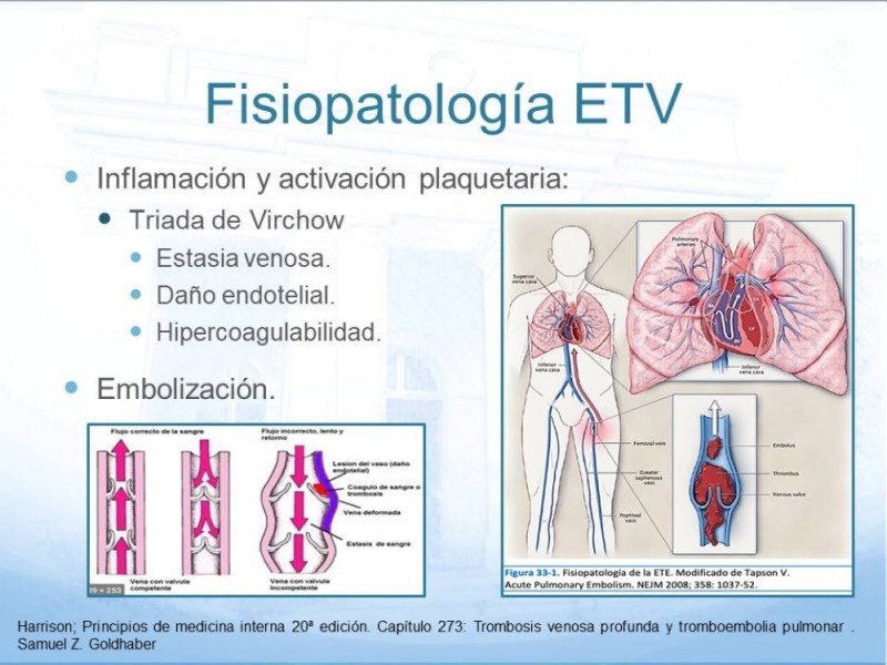 Diapositiva 5 de Tromboprofilaxis en cirugía