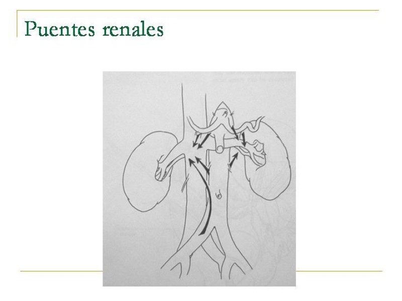 Diapositiva 90 de Accesos vasculares Abdominales