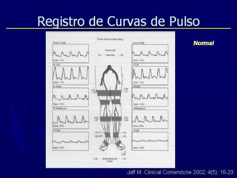 Diapositiva 33 de Clasificación, Definiciones y Estudio de EAO 