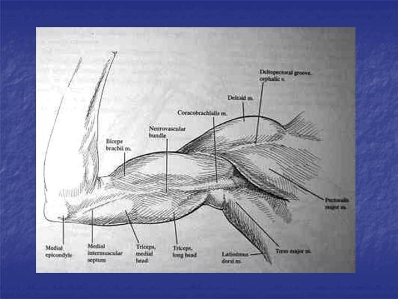 Diapositiva 65 de Abordaje Quirúrgico Vasculares