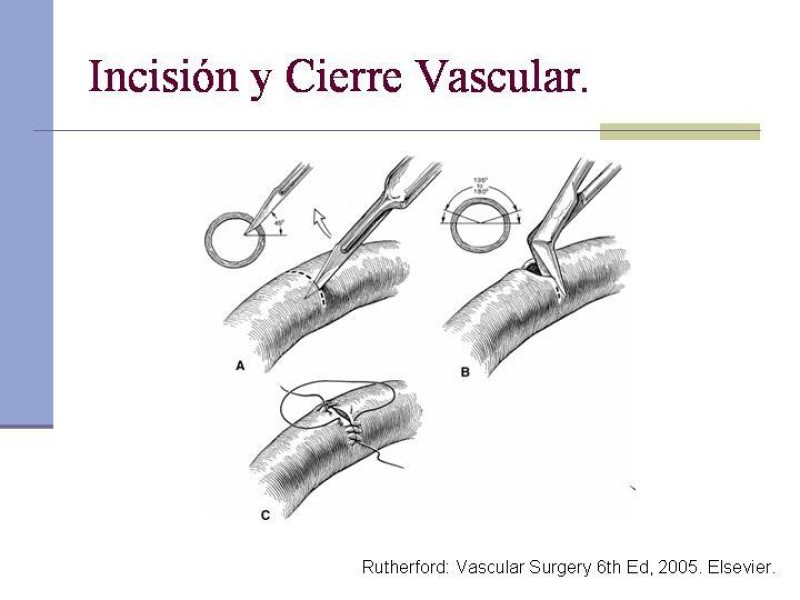 Diapositiva 16 de Reparación y Anastomosis Vasculares