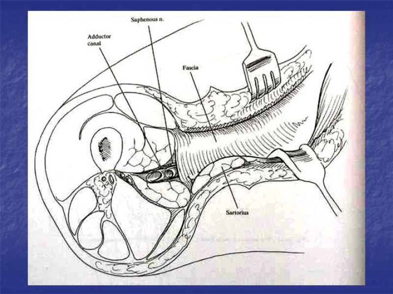 Diapositiva 100 de Abordaje Quirúrgico Vasculares