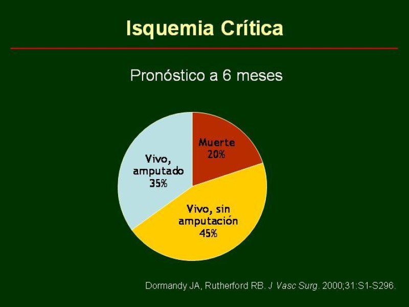 Diapositiva 21 de Clínica , Epidemiología y Factores Etiológicos de la Enf. Arterial Oclusiva Crónica