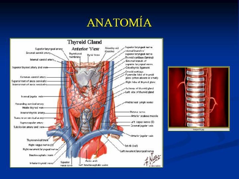 Diapositiva 8 de Traqueostomía Final