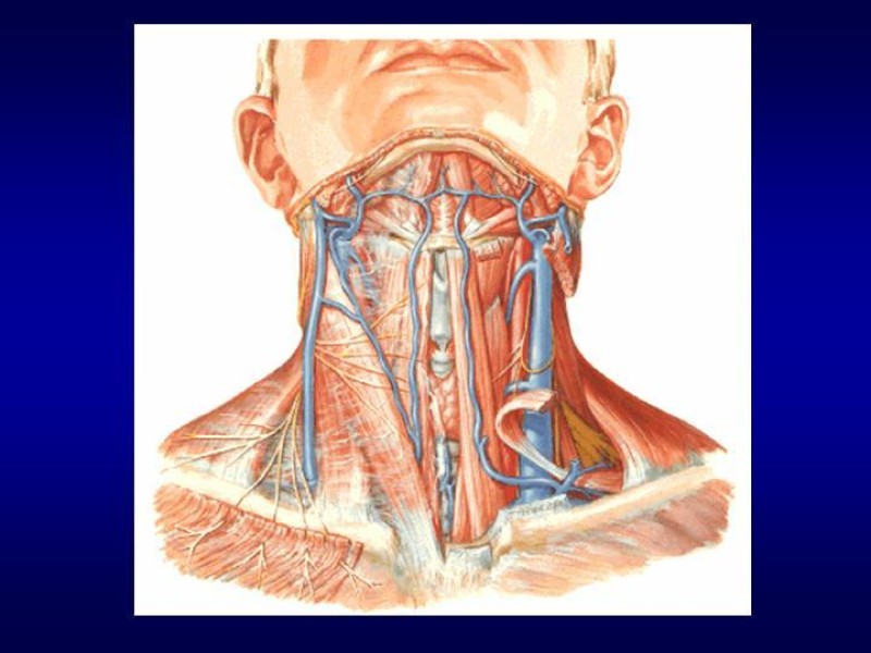 Diapositiva 6 de Tiroidectomía