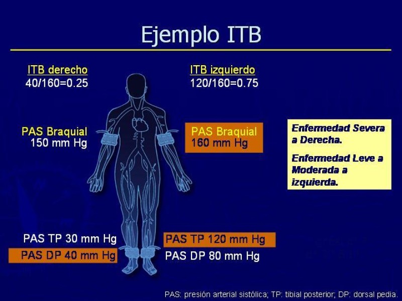 Diapositiva 25 de Clasificación, Definiciones y Estudio de EAO 