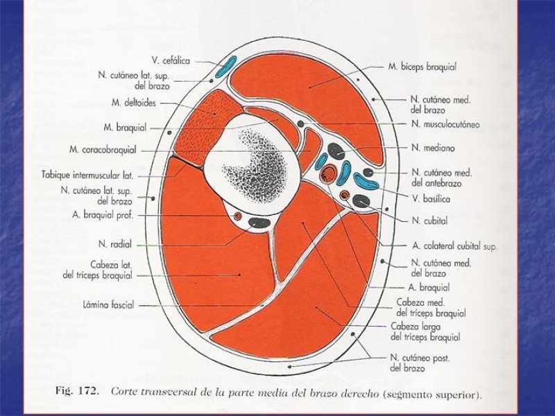 Diapositiva 63 de Abordaje Quirúrgico Vasculares