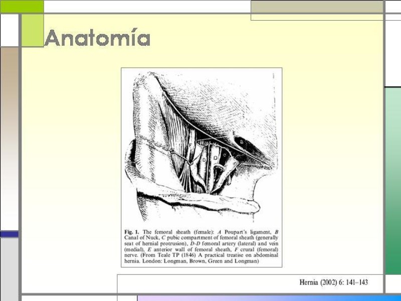Diapositiva 2 de Tratamiento de la Hernia Femoral