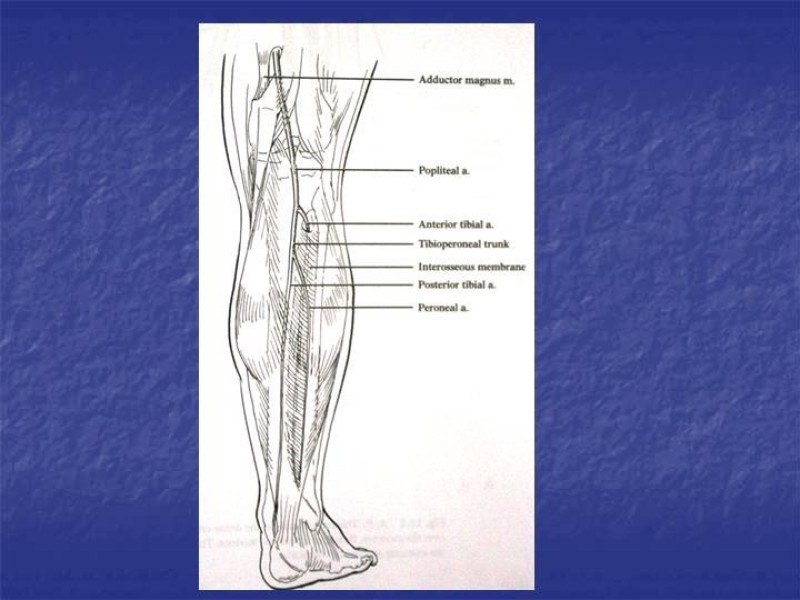 Diapositiva 106 de Abordaje Quirúrgico Vasculares