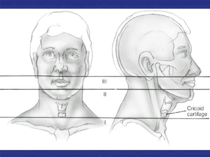 Diapositiva 12 de Abordaje Quirúrgico Vasculares