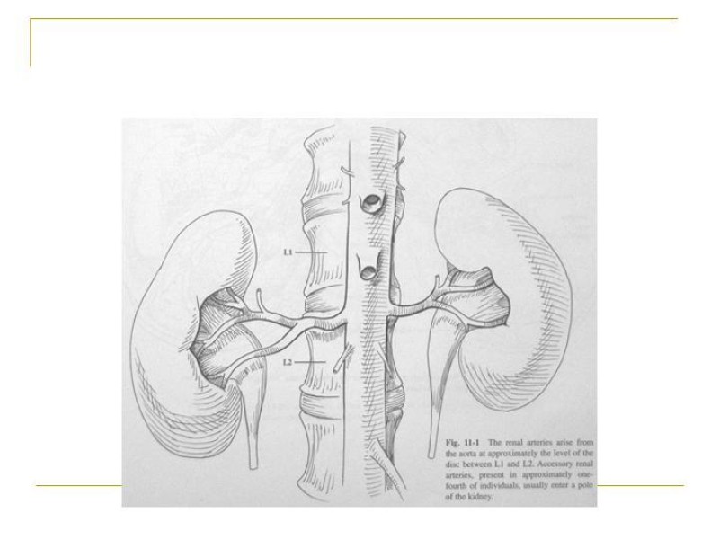 Diapositiva 82 de Accesos vasculares Abdominales