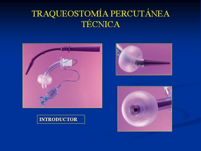 Diapositiva 28 de Traqueostomía Final