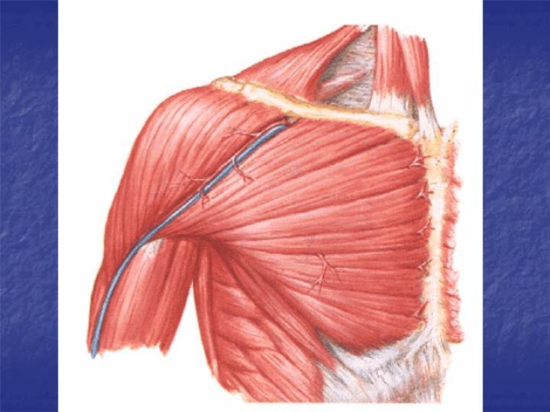Diapositiva 49 de Abordaje Quirúrgico Vasculares