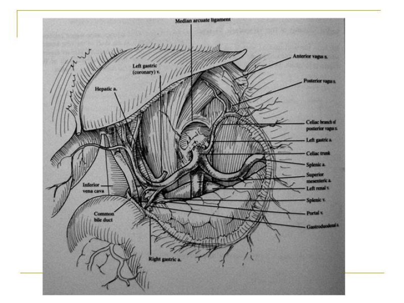 Diapositiva 59 de Accesos vasculares Abdominales