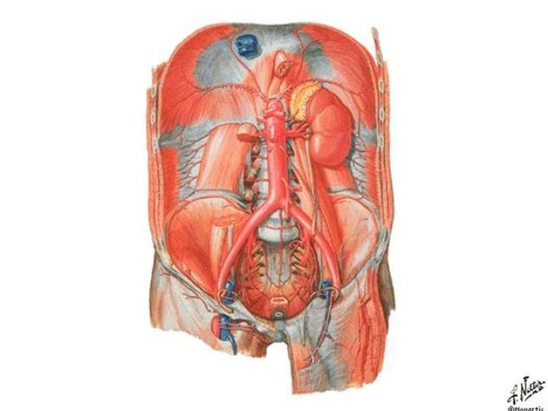 Diapositiva 1 de Accesos vasculares Abdominales