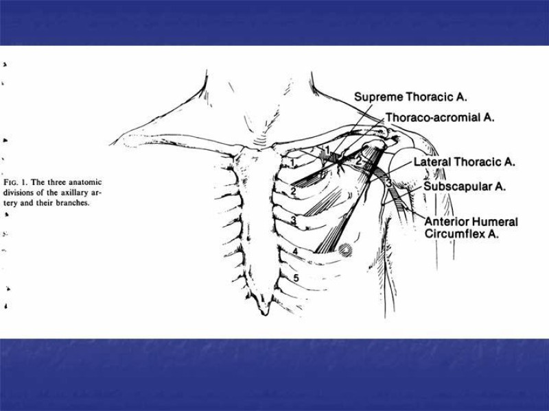 Diapositiva 53 de Abordaje Quirúrgico Vasculares