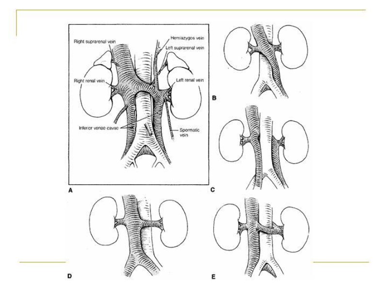 Diapositiva 36 de Accesos vasculares Abdominales