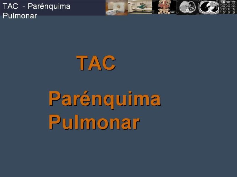 Diapositiva 56 de Imaginología Toráxica TAC