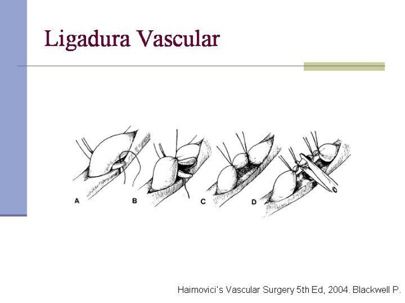 Diapositiva 9 de Reparación y Anastomosis Vasculares