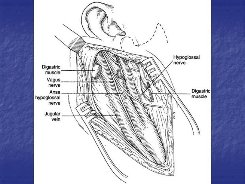 Diapositiva 33 de Abordaje Quirúrgico Vasculares