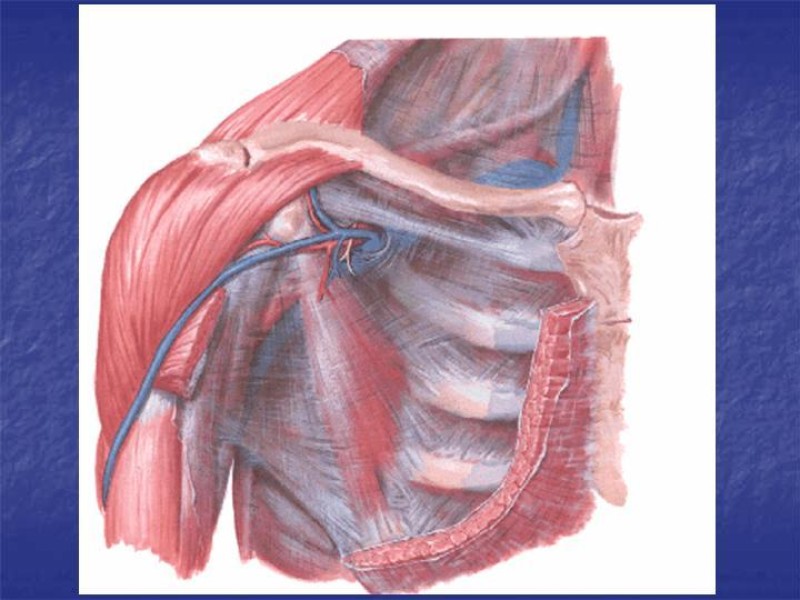Diapositiva 50 de Abordaje Quirúrgico Vasculares