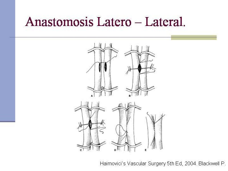 Diapositiva 28 de Reparación y Anastomosis Vasculares