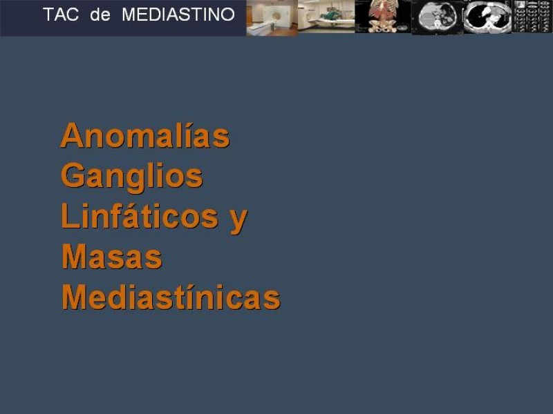Diapositiva 31 de Imaginología Toráxica TAC