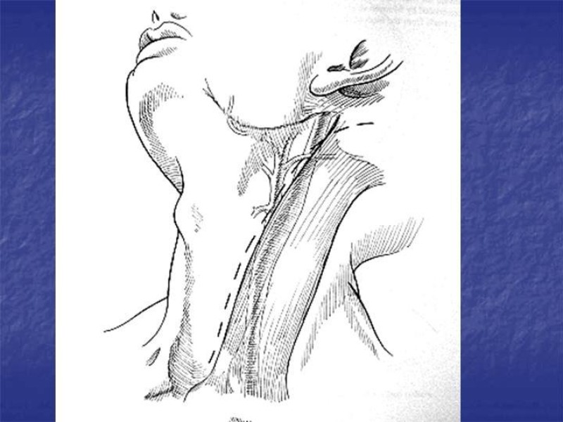 Diapositiva 25 de Abordaje Quirúrgico Vasculares