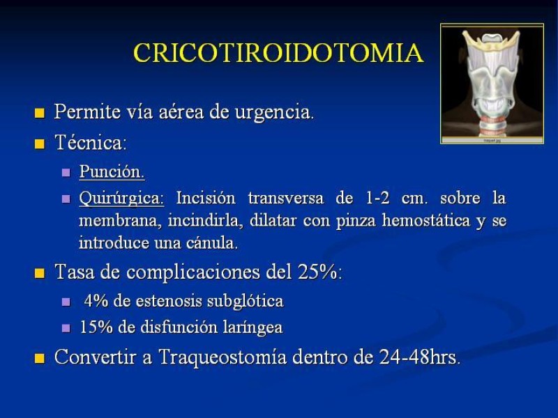 Diapositiva 31 de Traqueostomía Final