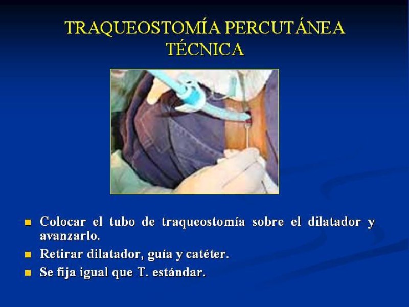 Diapositiva 29 de Traqueostomía Final