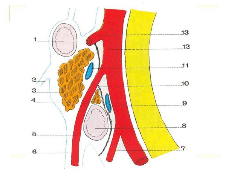 Diapositiva 5 de Accesos vasculares Abdominales