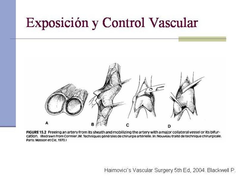 Diapositiva 5 de Reparación y Anastomosis Vasculares