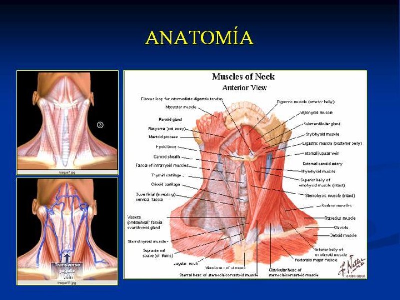 Diapositiva 7 de Traqueostomía Final