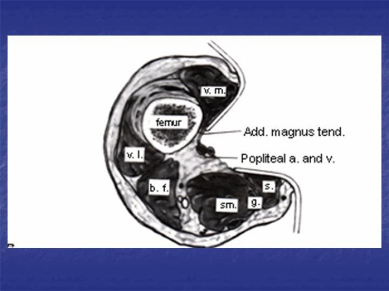Diapositiva 99 de Abordaje Quirúrgico Vasculares