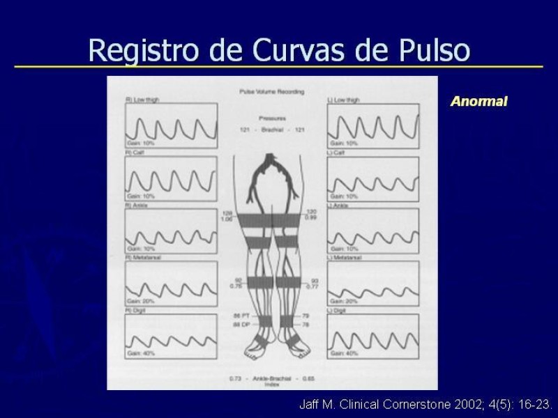 Diapositiva 34 de Clasificación, Definiciones y Estudio de EAO 
