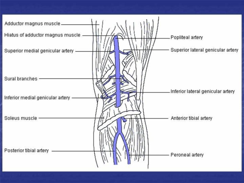 Diapositiva 101 de Abordaje Quirúrgico Vasculares