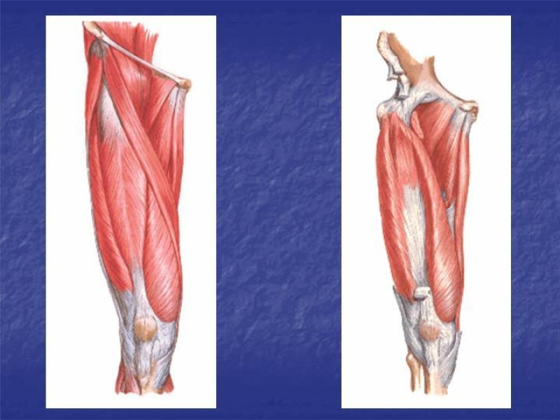 Diapositiva 79 de Abordaje Quirúrgico Vasculares