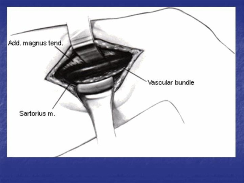Diapositiva 98 de Abordaje Quirúrgico Vasculares