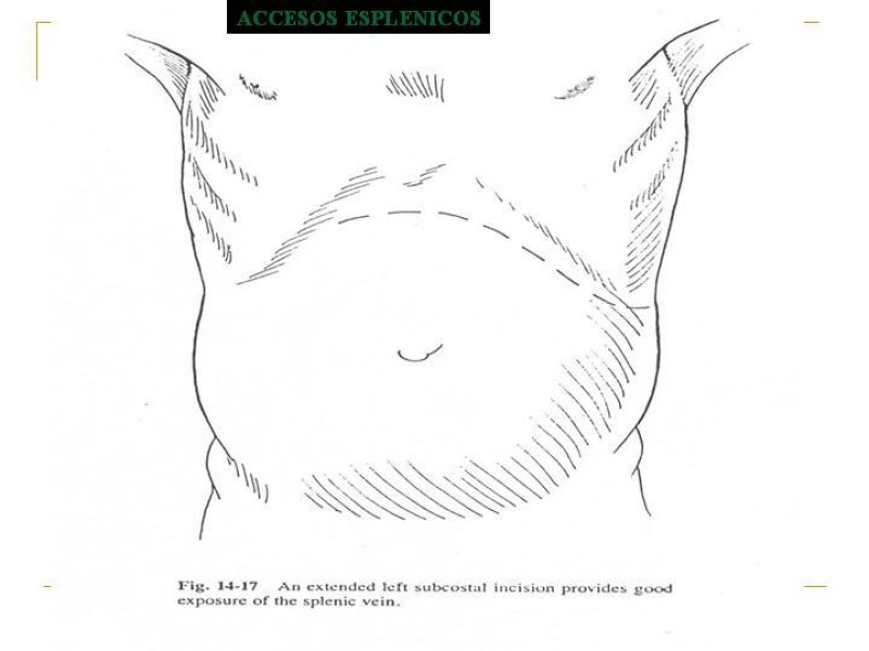 Diapositiva 98 de Accesos vasculares Abdominales
