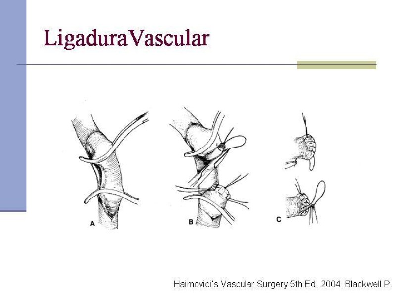 Diapositiva 10 de Reparación y Anastomosis Vasculares