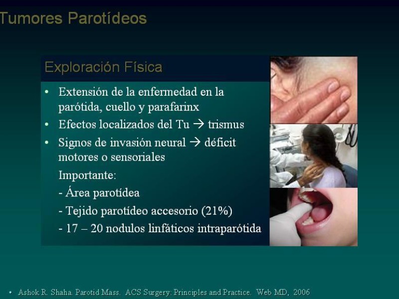Diapositiva 15 de Masas Parotídeas