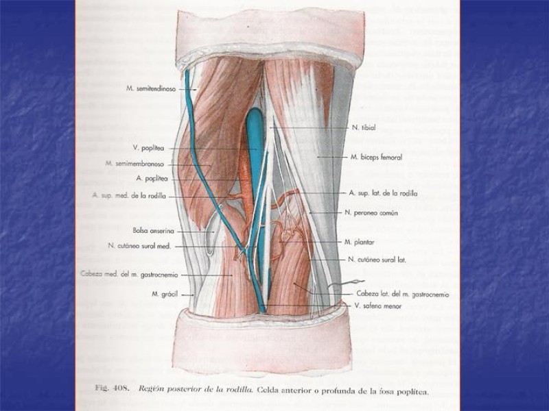 Diapositiva 102 de Abordaje Quirúrgico Vasculares
