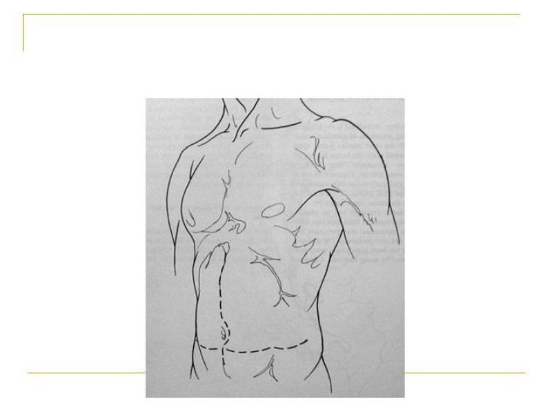 Diapositiva 49 de Accesos vasculares Abdominales