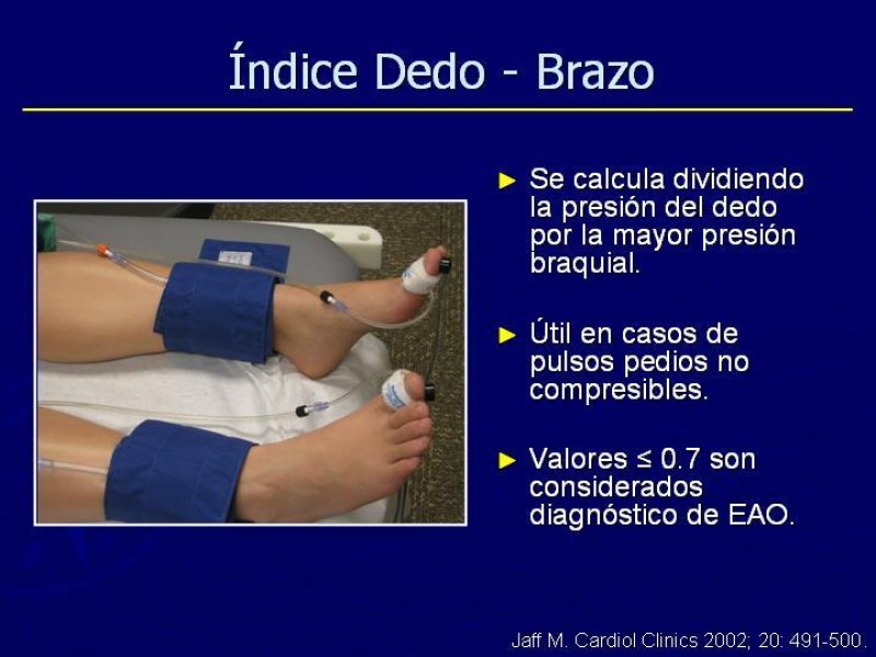 Diapositiva 28 de Clasificación, Definiciones y Estudio de EAO 