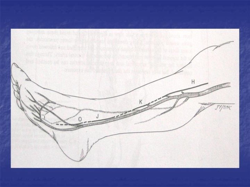Diapositiva 115 de Abordaje Quirúrgico Vasculares