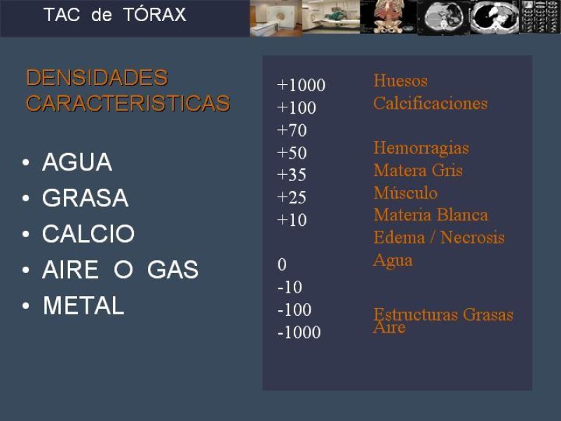 Diapositiva 1 de Imaginología Toráxica TAC