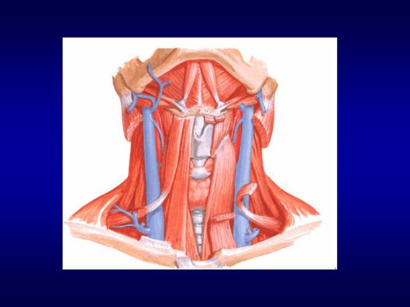 Diapositiva 7 de Tiroidectomía