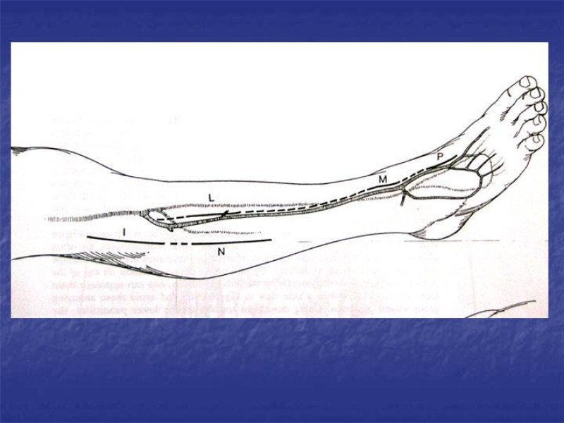 Diapositiva 107 de Abordaje Quirúrgico Vasculares