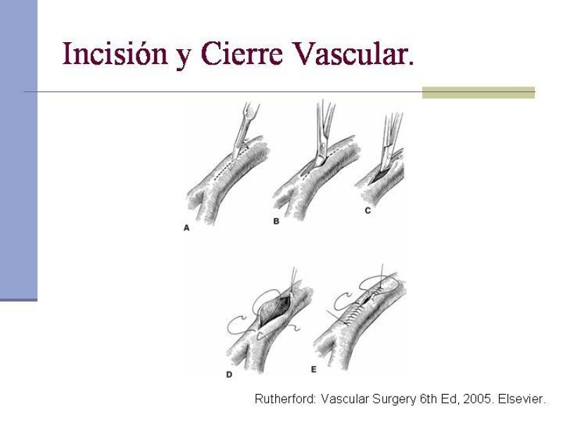 Diapositiva 15 de Reparación y Anastomosis Vasculares